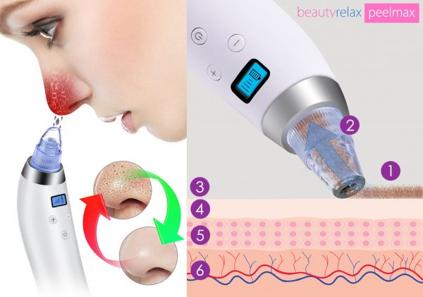 Diamantová mikrodermabraze BeautyRelax Peelmax