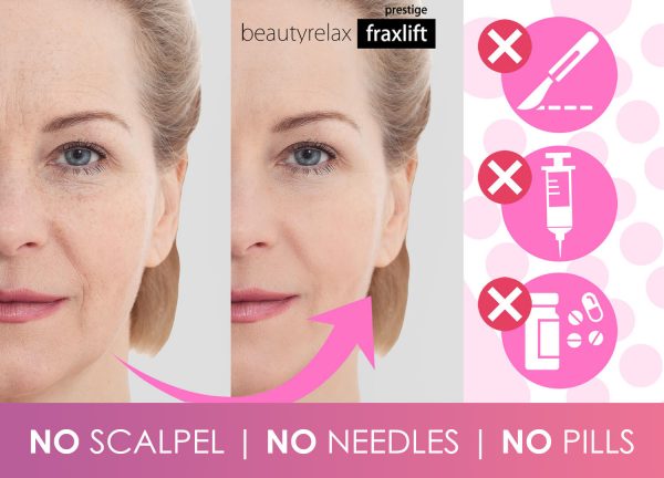 Kosmetický přístroj Beautyrelax Fraxlift Prestige