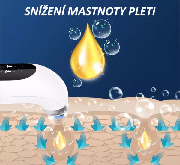 Kosmetický přístroj BeautyRelax Poremax Oxygen