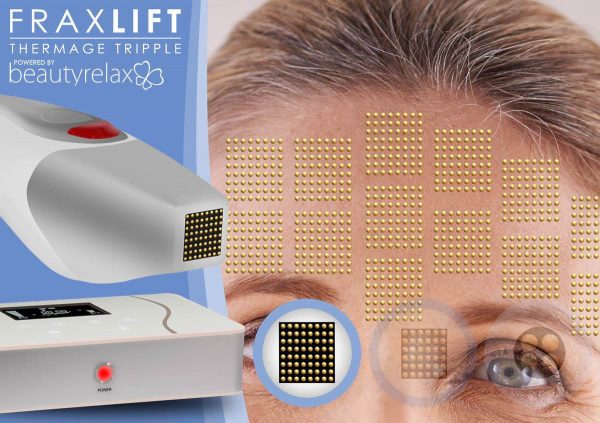 Estetický přístroj pro lifting pleti BeautyRelax Fraxlift Thermage Tripple Attack