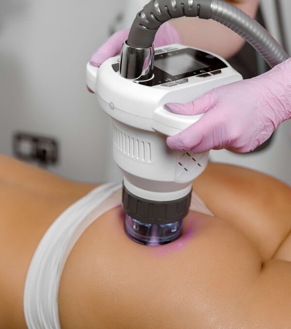 Masážny prístroj na celulitídu BeautyRelax VacuSpin Professional