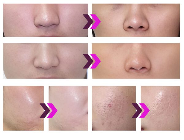 Kozmetický prístroj BeautyRelax PlasmaForce Professional Studio