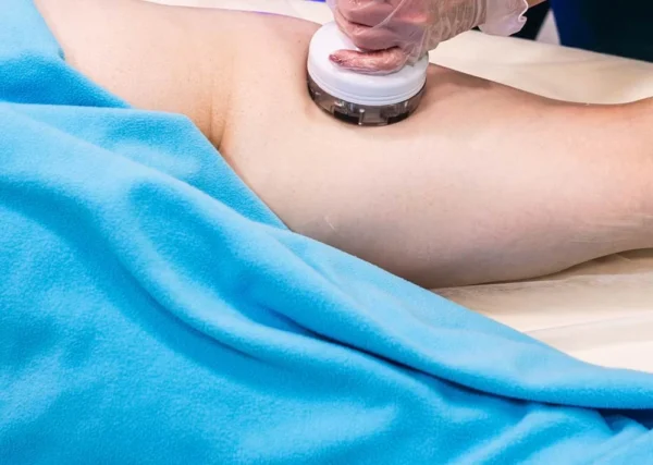 Masážny prístroj na celulitídu BeautyRelax Rollskin BodyShape Madero Professional Sculptor Elite