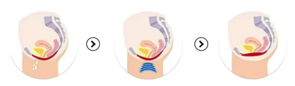Masážne kreslo na panvové svaly BeautyRelax Pulsemax Magnetic Studio Professional
