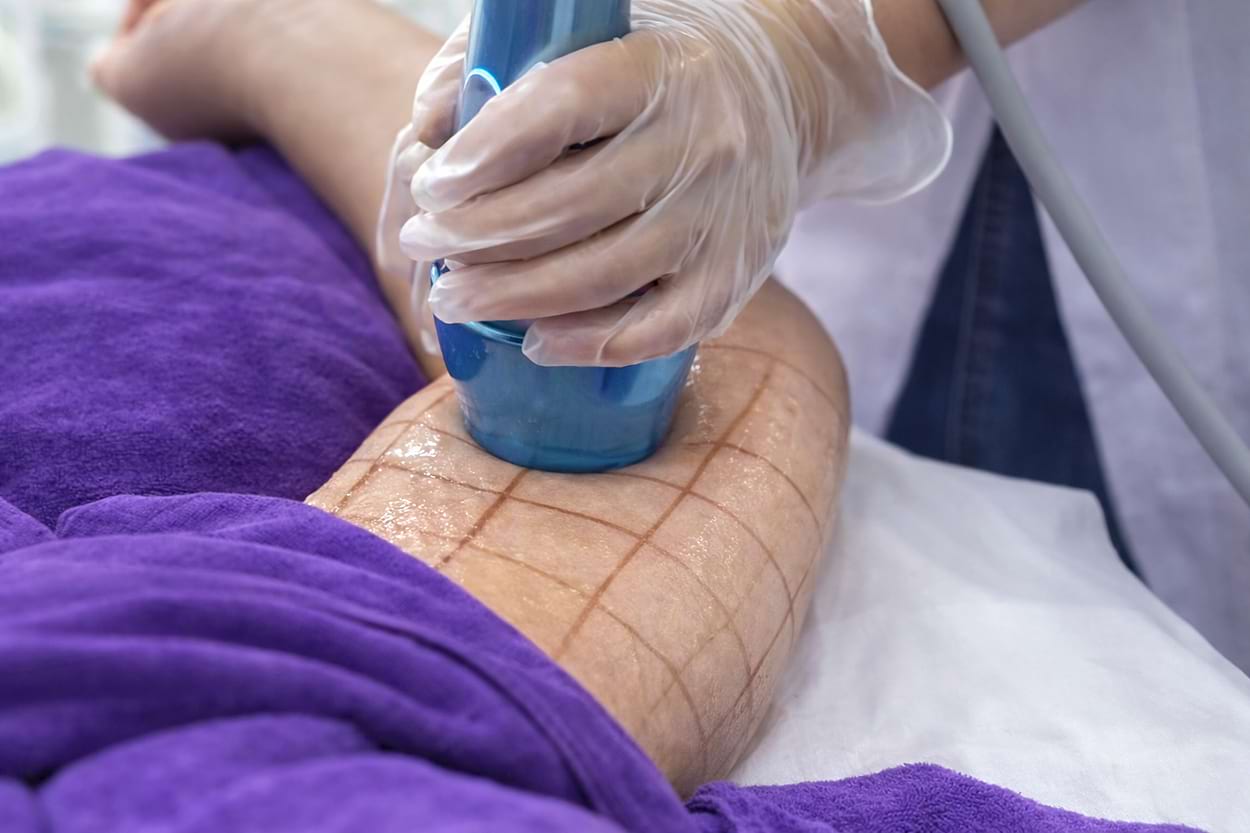 Estetický prístroj BeautyRelax Bodyshape HIFU Tripple Attack Studio