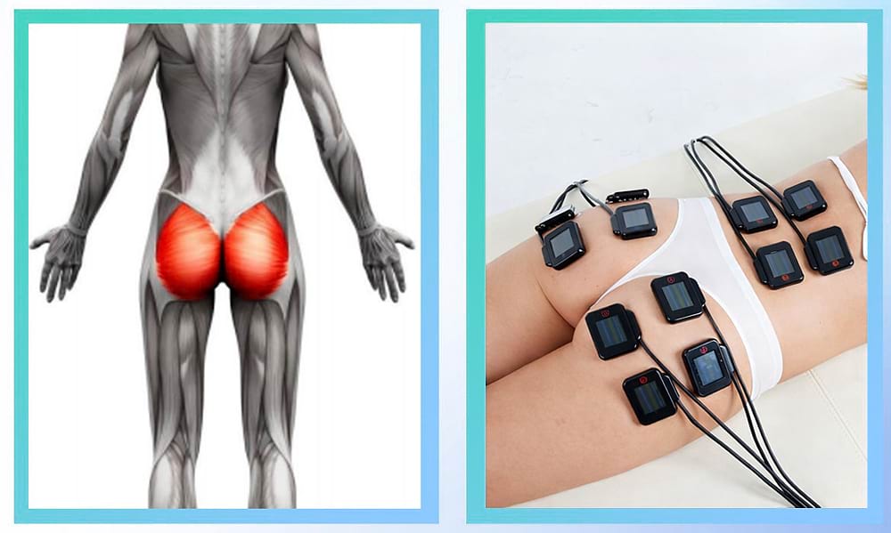 Masážny prístroj na formovanie postavy BeautyRelax Magnetic Pulsemax Studio Performance – Obrázok 10