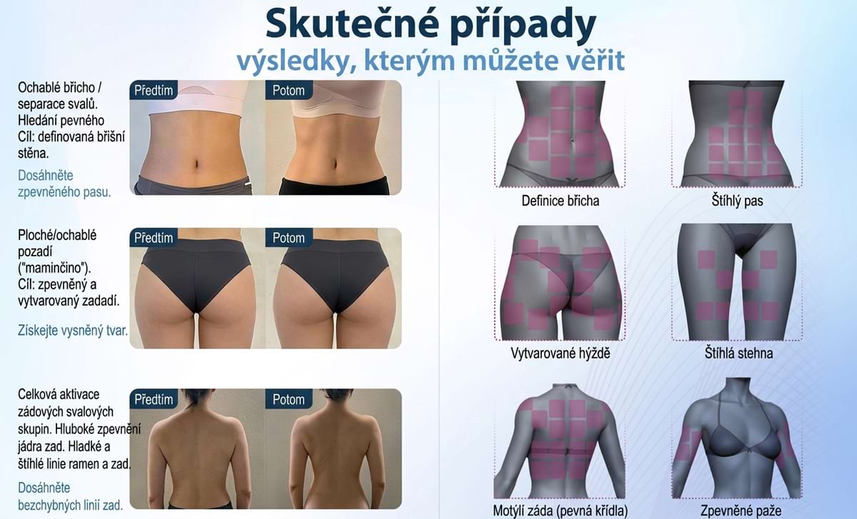 Masážny prístroj na formovanie postavy BeautyRelax Magnetic Pulsemax Studio Performance – Obrázok 20