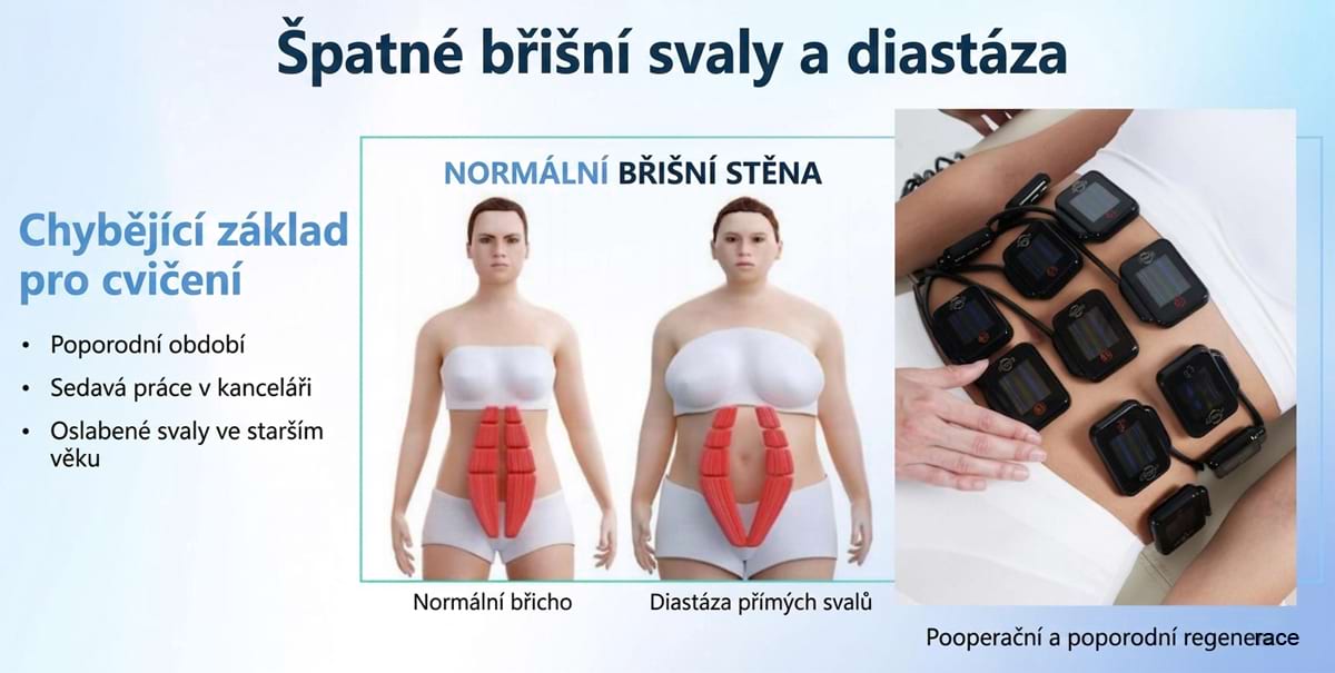 Masážny prístroj na formovanie postavy BeautyRelax Magnetic Pulsemax Studio Performance – Obrázok 16