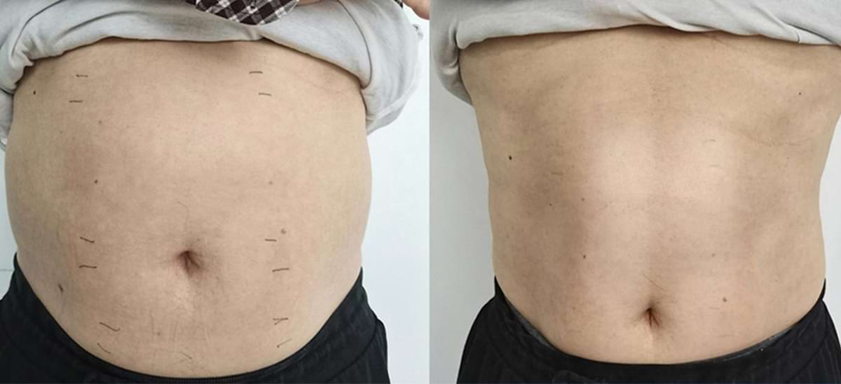 Masážny prístroj na formovanie postavy BeautyRelax Magnetic Pulsemax Studio Performance – Obrázok 27