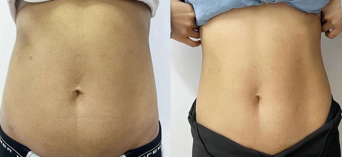 Masážny prístroj na formovanie postavy BeautyRelax Magnetic Pulsemax Studio Performance – Obrázok 26