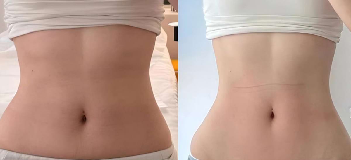 Masážny prístroj na formovanie postavy BeautyRelax Magnetic Pulsemax Studio Performance – Obrázok 34