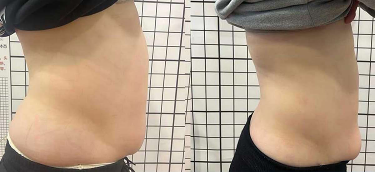 Masážny prístroj na formovanie postavy BeautyRelax Magnetic Pulsemax Studio Performance – Obrázok 33