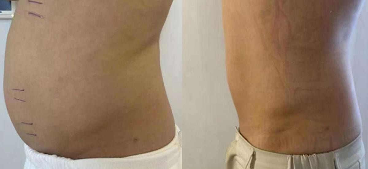 Masážny prístroj na formovanie postavy BeautyRelax Magnetic Pulsemax Studio Performance – Obrázok 32