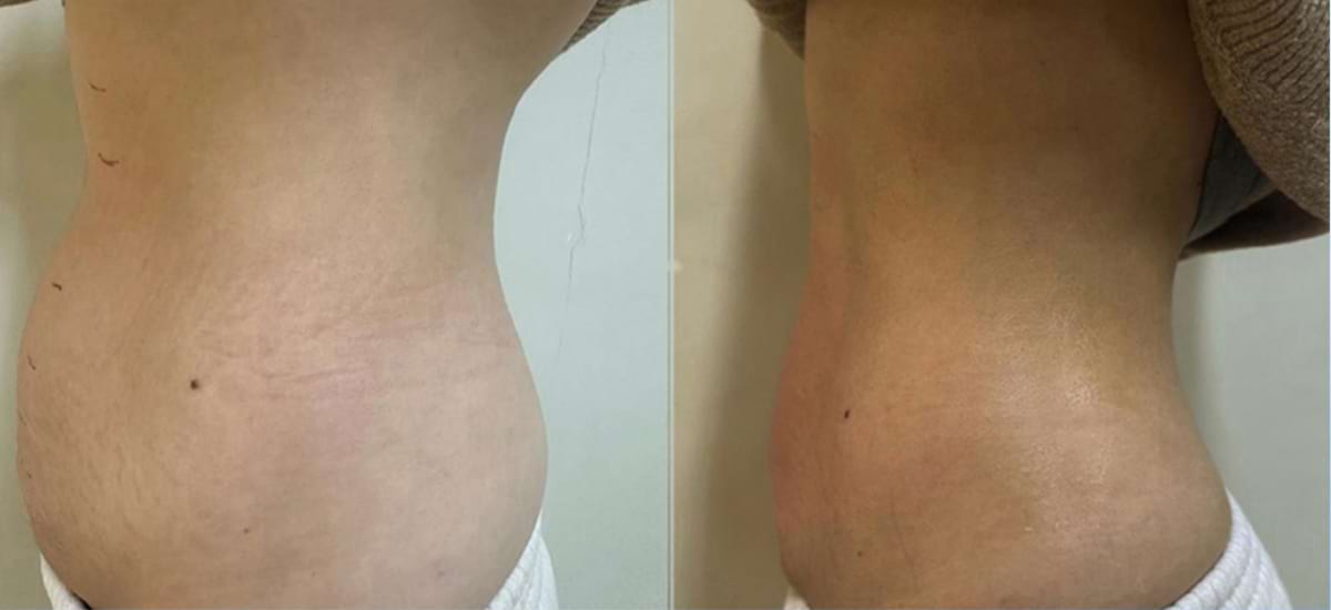 Masážny prístroj na formovanie postavy BeautyRelax Magnetic Pulsemax Studio Performance – Obrázok 31