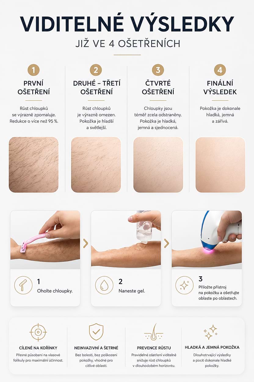 Estetický multifunkčný prístroj BeautyRelax Studio Excellence – Obrázok 9