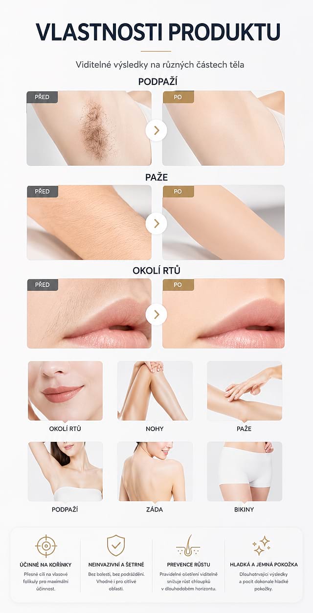 Estetický multifunkčný prístroj BeautyRelax Studio Excellence – Obrázok 8