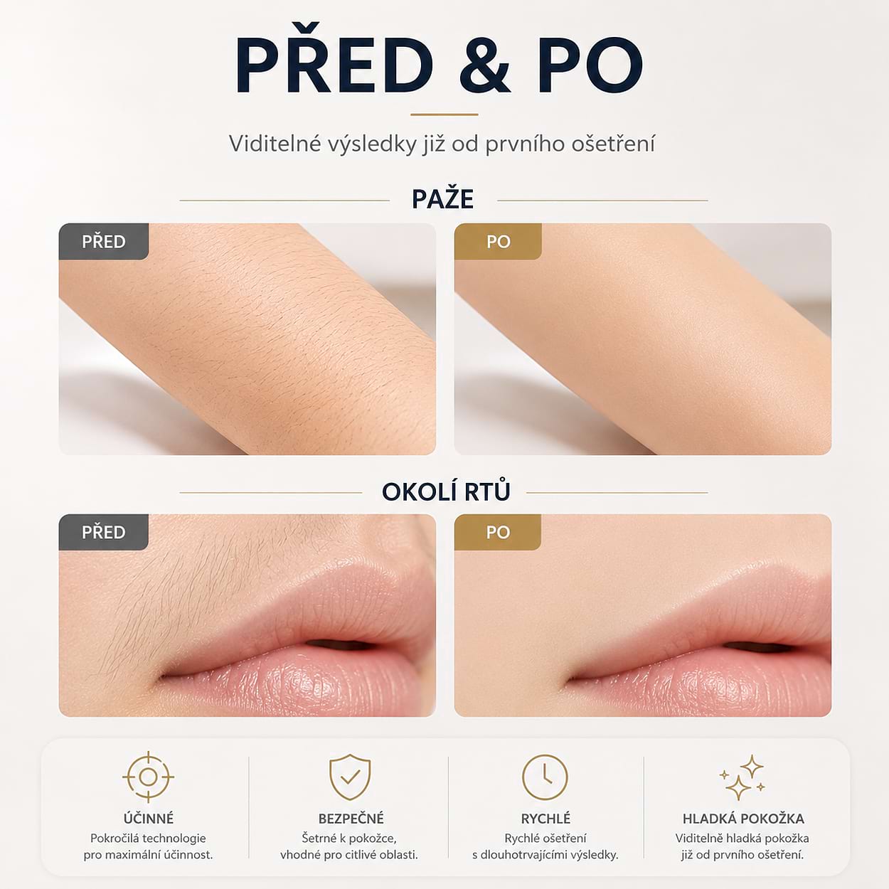 Estetický multifunkčný prístroj BeautyRelax Studio Excellence – Obrázok 7