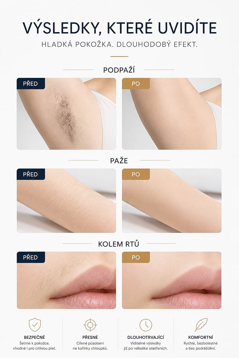 Estetický multifunkčný prístroj BeautyRelax Studio Supreme – Obrázok 7