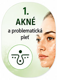 Akné