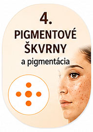 Pigmentové škvrny