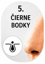 Čierne bodky