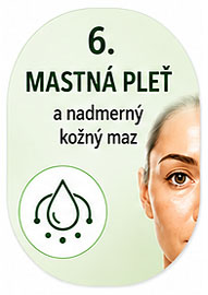 Mastná pleť
