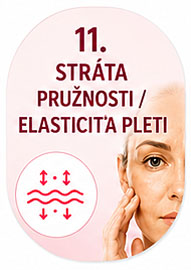 Strata pružnosti