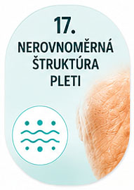 Nerovnoměrná štruktúra pleti