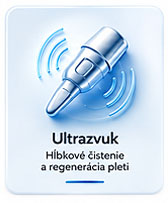 Ultrazvuk